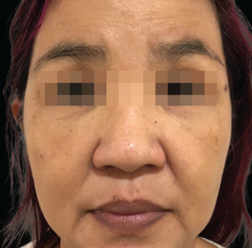 Before/After Image